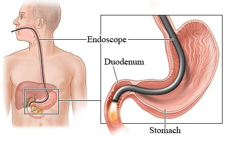 Dr. Vinit Kahalekar Gastroenterologist in Aurangabad